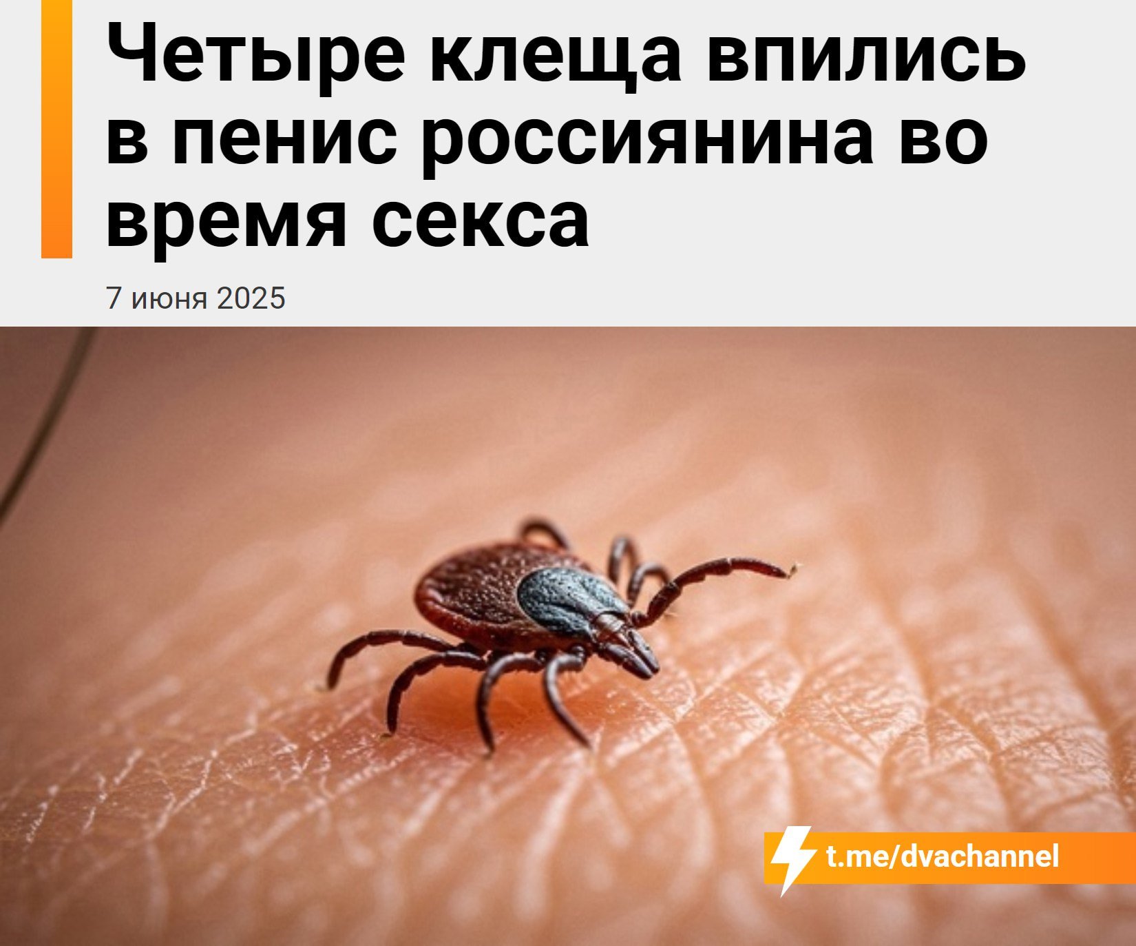 Четыре клеща впились в пенис мужчины во время секса в Новосибирске Влюблённая парочка обратилась в частную клинику с жалобами на зуд в интимной зоне: Во время осмотра они сообщили, что занимались сексом в Первомайском сквере, и после этого у них появилось "беспокойство". Последствия оказались серьёзными: у женщины было найдено четыре клеща во влагалище, ей потребовалась операция. Столь же много паразитов нашли и у мужчины. — рассказал журналистам врач одной из новосибирских клиник Суровые сибирские клещи передаются половым путём
