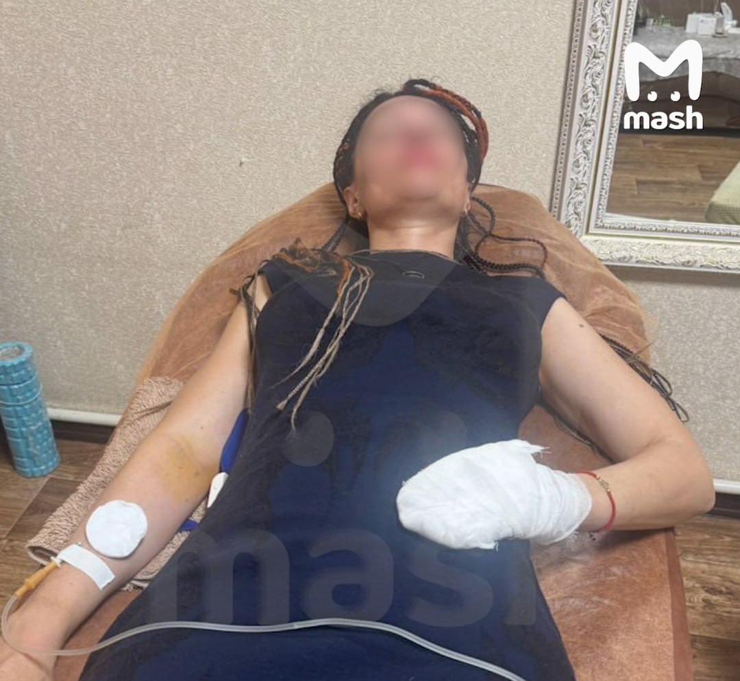 Ставропольчанке ампутируют палец из за обморожения при восхождении на Хан Тенгри Сейчас женщина проходит лечение и находится под капельницами по 7 часов в день Виктория работала стилистом парикмахером и после ампутации пальца вернуться к профессии не сможет пишет телеграм канал Mash Виктория отправилась в поход имея опыт выживания в горах За ее плечами девять восхождений в том числе на Эльбрус Казбек и пик Ленина Обычно она путешествовала самостоятельно но в этот раз решила нанять гида Григория Кочеткова заплатив ему 3 5 тысячи долларов Вдвоем они отправились на вершину Хан Тенгри гора высотой 7100 метров расположенная на границе Киргизии Казахстана и Китая По словам Виктории экспедиция прошла крайне неудачно и винит в этом Кочеткова На спуске гид постоянно кричал на нее унижал и плохо вязал узлы Женщина сорвалась в трещину и выбиралась самостоятельно поскольку Кочетков не оказал помощи По пути к группе присоединился еще один альпинист На обратном пути он отделился от основной группы из за усталости и погиб мужчина уснул в палатке с включенной лампой и задохнулся от углекислого газа Год назад на маршруте у Кочеткова уже погиб турист от сердечной недостаточности Сам гид утверждает что спас Викторию поскольку она была не готова к такому сложному маршруту и возлагает вину за инциденты на нее Киргизская ассоциация горных гидов начала внутреннее расследование произошедшего 1777 ЧП Ставрополь