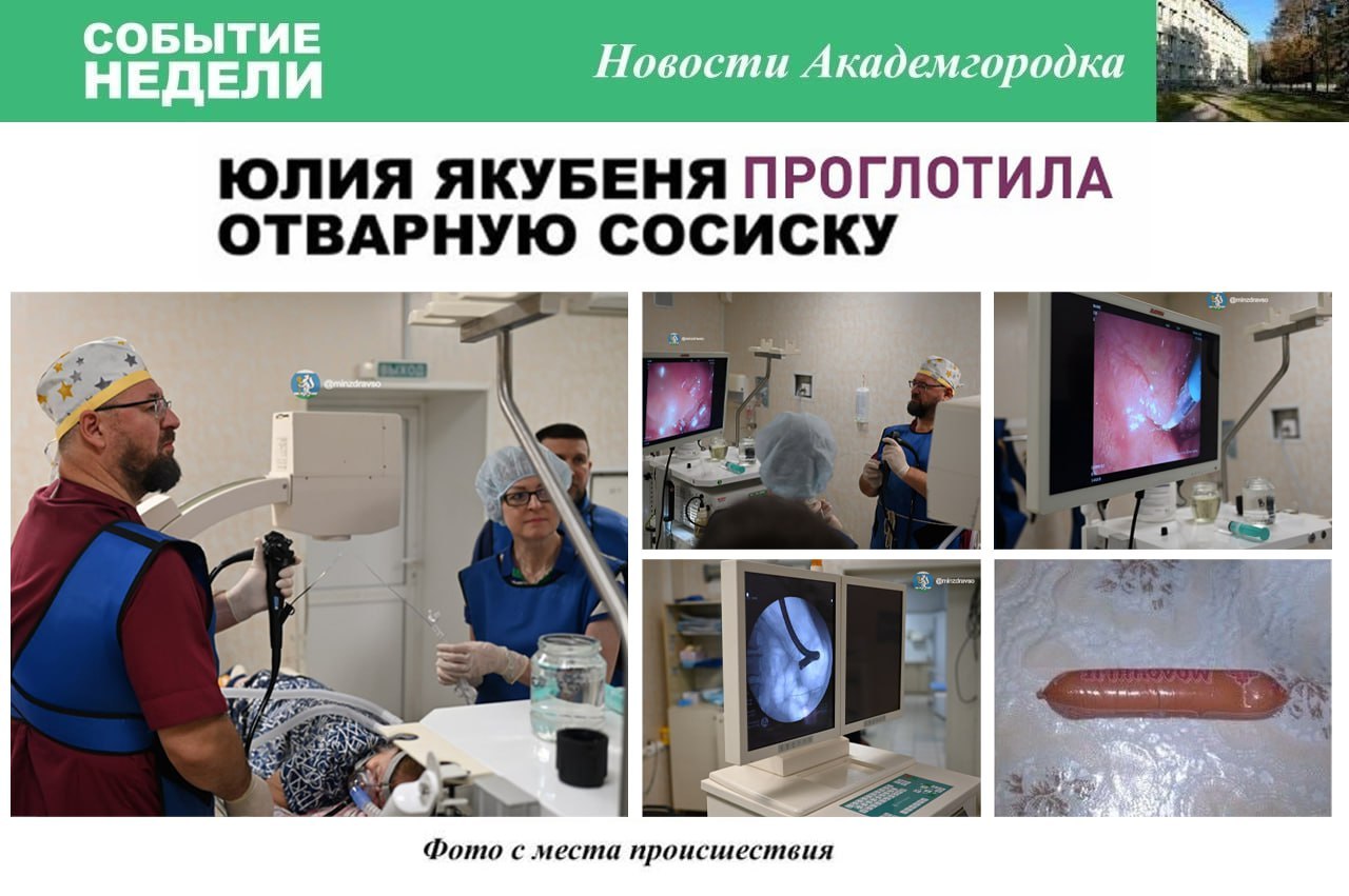 В Екатеринбурге сосиска чуть не убила 70 летнюю женщину Из за нехватки зубов пенсионерка нечаянно проглотила сосиску целиком продукт застрял на границе пищевода и желудка перекрыв возможность есть и пить Во время операции врачи рассекли сосиску и протолкнули ее части в желудок А что ещё случилось