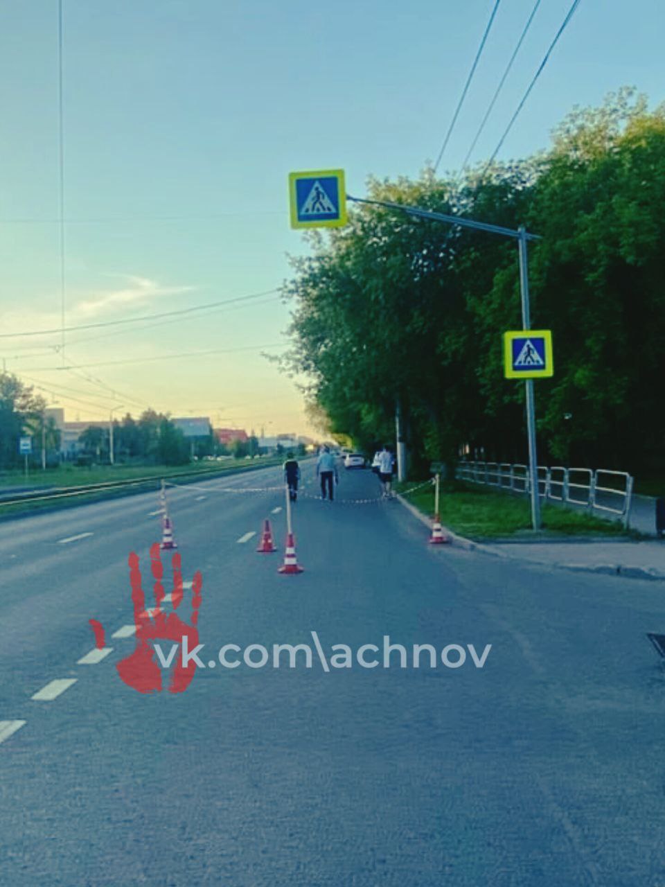  Юный бесправник на легковушке отправил одну женщину на больничную койку Жительницу Челябинской области госпитализировали после того, как она перешла дорогу. Попасть на другую сторону проезжей части 51-летней даме так и не удалось. Ее сбила машина. Дорогу пострадавшая переходила по регулируемому пешеходному переходу. В этот момент там ехал ВАЗ-21099. Сотрудники ГИБДД говорят, что машиной управлял 17-летний парень. - Выполняя маневр правого поворота по зеленому сигналу светофора, не уступил дорогу и совершил наезд на пешехода. Женщина получила телесные повреждения, госпитализирована в медицинское учреждение, - комментируют в Госавтоинспекции. Авария произошла 29 мая на пересечении переулка Советского с улицей Советской. Прав на вождение у юного нарушителя не было. Он попал сразу под несколько статей, в числе которых и протокол за наглухо затонированные стекла и за нарушение ПДД, повлекшее причинение легкого или средней тяжести вреда здоровью потерпевшего. Проводится административное расследование.