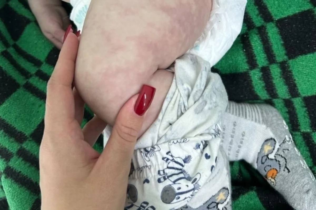 По факту гибели ребенка в больнице Фокино возбуждено уголовное дело   Прокуратура признала законным возбуждение уголовного дела по факту халатности со стороны врачей. В феврале 2025 года мальчик, семимесячный малыш был доставлен в больницу города Фокино с ухудшением состояния здоровья.    Ребенок скончался в реанимации в городе Фокино, после экстренной госпитализации. Следственный комитет возбудил уголовное дело по части 2 статьи 109 УК РФ - причинение смерти по неосторожности вследствие ненадлежащего исполнения лицом своих профессиональных обязанностей.   Подробнее в «АиФ - Приморье»