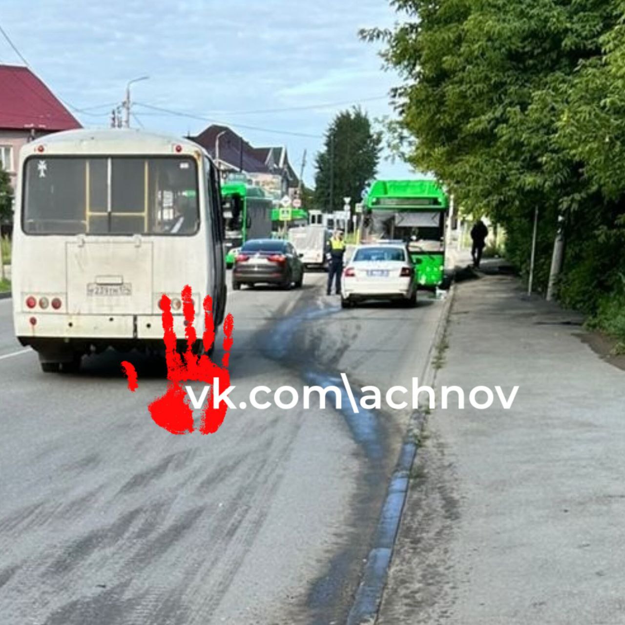 Городской автобус 51-го маршрута влетел в автобус номер 5. Есть пострадавшие.    Авария произошла сегодня утром на улице Кузнецова. По словам свидетелей, в результате аварии ренения получили пассажиры.  - 51-ый будто неуправляемый был, вилял. И въехал в автобус 5. Была "скорая помощь", кого-то из пятерки увезли в больницу, - рассказали очевидцы.  Судя по фото с места ДТП, один из городских автобусов получил серьёзные повреждения.