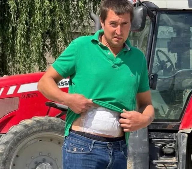 Войны не заканчиваются по щелчку пальца, а еще долго напоминают о себе. На днях бельгийский фермер выковырял трактором несколько снарядов Первой мировой войны. Не мудрствуя лукаво, он взял и отнес их на край поля, чтоб не мешали. А на следующий день на животе пошли нарывы и покраснение. Оказывается, в поврежденном снаряде был горчичный газ иприт . А парень тащил его, прижимая к животу.