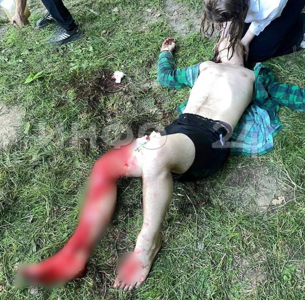 Неадекват напал с ножом на парня в Нижнем Новогороде. Молодой человек вступился за знакомых девушек. В Нижнем Новгороде на озере Щелковского хутора 20-летний Сергей получил ножевое ранение, защищая двух несовершеннолетних девушек от 50-летнего мужчины, рассказали Инфо24 знакомые пострадавшего. Инцидент произошел в понедельник, когда неадекватный мужчина начал приставать к девочкам 13 и 16 лет с непристойными предложениями, хвастаясь пирсингом на интимном месте. Получив отказ, он не успокоился. Когда Сергей с друзьями дали ему отпор, агрессор ударил молодого человека ножом в ногу. Рана глубиной 3 см оказалась неопасной, артерия не была задета. Сейчас пострадавший проходит амбулаторное лечение, полиция разыскивает нападавшего, который, по словам очевидцев, был пьян. “Чувствую себя чуть лучше, чем печально, надеюсь, виновника поймают и накажут по всей строгости”, — рассказал Инфо24 Сергей. Прислать новость