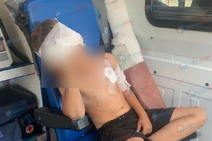 Волк покусал 8 летнего мальчика в Ростовской области В Гукове 8 летний мальчик стал жертвой нападения волка Как сообщили в ГУ МВД Ростовской области ребёнок получил множественные раны По информации полицейских инцидент произошёл дома у одной из его одноклассниц Туда компания школьников отправилась чтобы посмотреть на волка которого семья держала в вольере Когда дети подошли к клетке девочка открыла её В тот момент животное и набросилось на мальчика ростов новостировстова ростовскаяобласть Подпишись на donnewsru