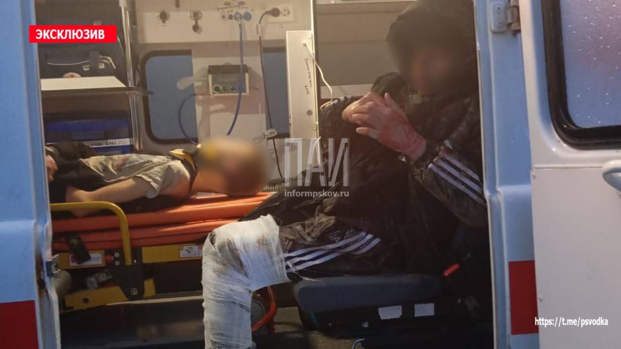 В селе Павы Порховского района на улице Псковской произошло ДТП с участием автомобиля Renault и мотоцикла "Дельта". За рулём мотоцикла находились подростки 12 и 14 лет. Оба несовершеннолетних с травмами различной степени тяжести госпитализированы бригадой скорой помощи в медицинское учреждение Пскова. На месте происшествия работают пожарные, медики и сотрудники ГАИ. Проводится проверка.