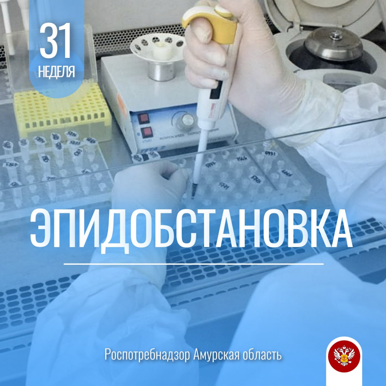#Эпидобстановка Продолжается активная циркуляция энтеровирусов. На минувшей неделе число случаев энтеровирусной инфекции выросло в 3,4 раза, показатель составил 12,13 на 100 тыс. населения. Заболеваемость преимущественно регистрируется среди детей 1-6 лет 87% , посещающих детские образовательные учреждения, где регистрируются очаги групповой заболеваемости. На 32 неделе заболеваемость ОКИ снизилась на 5,2% по отношению к предыдущей неделе, показатель составил 14,68 на 100 тыс. населения, что на 19,2% выше среднемноголетнего показателя. Случаи ОКИ преимущественно регистрировались среди детей в возрасте 1-14 лет 68,2% . Зарегистрировано 47 обращений по поводу укусов клещей, в том числе 10 среди детей, что на 9,3% больше предыдущей недели. В лабораторию доставлено 22 клеща от населения, выявлено по 1 положительной находке на возбудители КВЭ, клещевого боррелиоза и анаплазмоза. Показатель заболеваемости ОРВИ на 32 неделе составил 13,01 в расчёте на 10 тыс. населения, что на 24,8% выше показателя прошлой недели и на 4,9% выше уровня аналогичного периода прошлого года. Эпидемические пороги не превышены. Показатель заболеваемости внебольничными пневмониями составил 9,56 на 100 тыс. населения, что на 7,5% выше уровня заболеваемости предыдущей недели. Заболеваемость COVID-19 выросла на 41,7% по отношению к предыдущей неделе, показатель составил 2,26 на 100 тыс. населения, что на 88,9% выше аналогичного периода прошлого года. Заболеваемость преимущественно протекала в форме ОРВИ. Уважаемые амурчане, соблюдайте меры профилактики инфекционных заболеваний в общественных местах, дома, на работе, на отдыхе. Не прибегайте к самолеченною, при первых признаках заболевания обращайтесь за медицинской помощью. Роспотребнадзор Амурская область