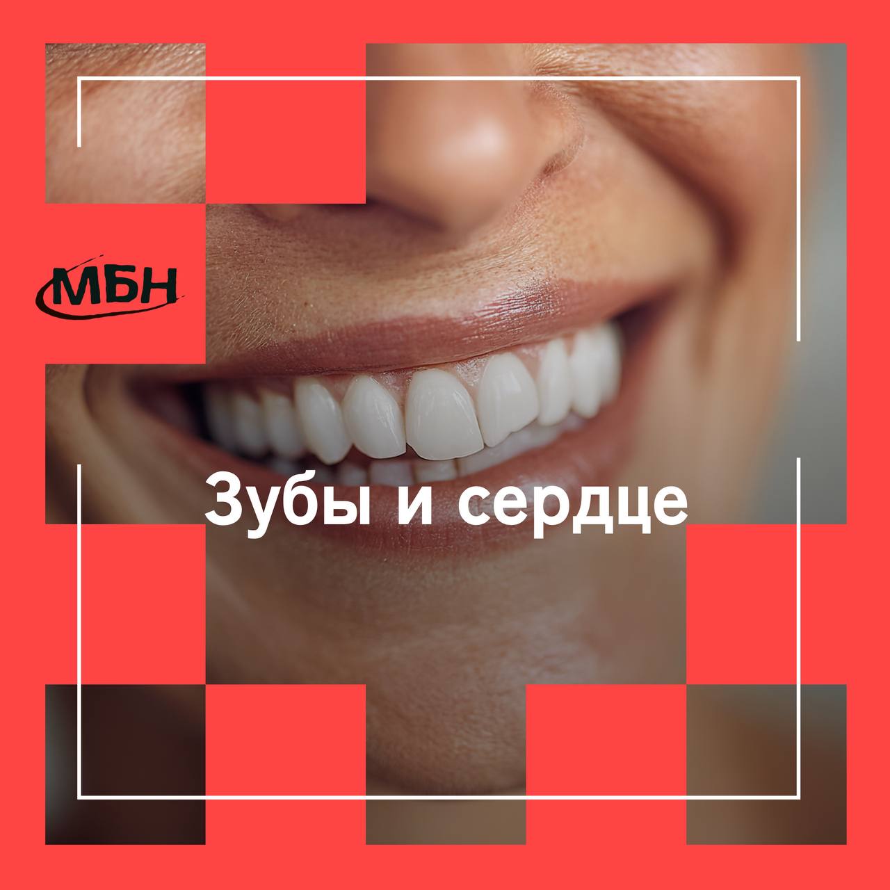 Проблемы с зубами могут почти вдвое увеличить риск инсульта 20 летнее исследование показало связь между здоровьем полости рта и сердечно сосудистой системой Среди людей со здоровыми зубами инсульт случился у 4 участников тогда как у тех кто страдал одновременно кариесом и пародонтитом риск достиг 10 Ученые объясняют это хроническим воспалением и бактериями которые поражают не только десны но и кровеносные сосуды повышая вероятность нарушений мозгового кровообращения Почистили зубы с утра mbn360