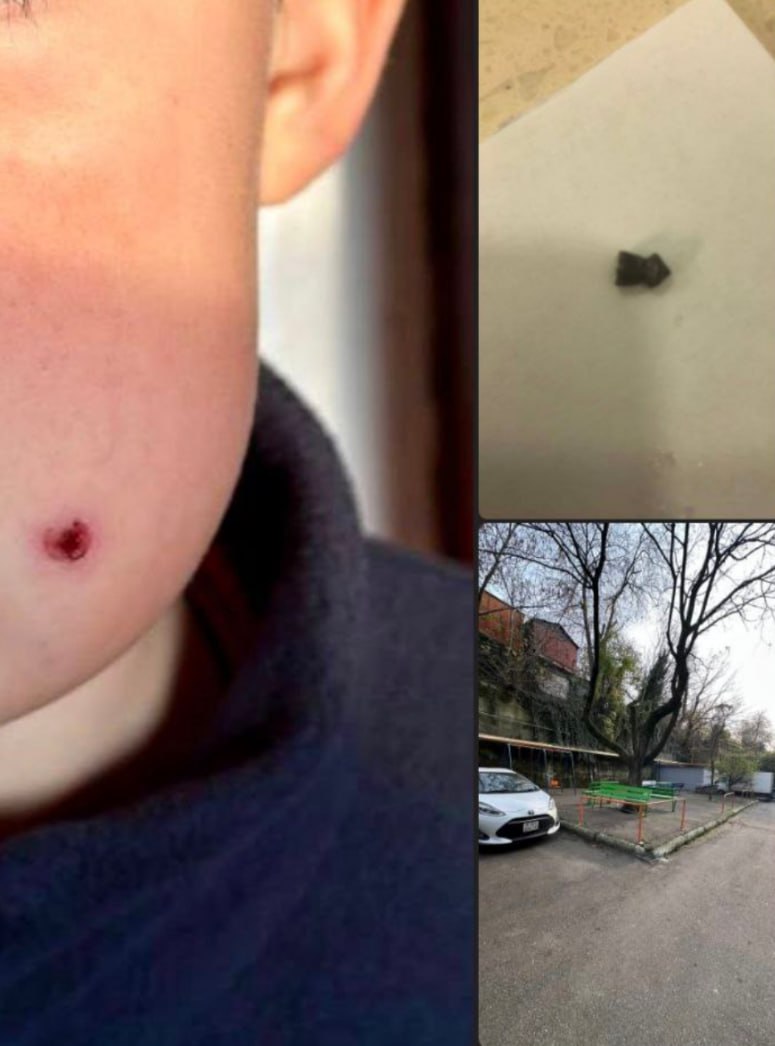 В Туапсе неизвестный выстрелил в ребенка Полиция проводит проверку Инцидент произошел на улице Шаумяна Злоумышленник выстрелил из пневматического оружия в девятилетнего мальчика сообщили в региональном МВД Пуля попала ему в щеку его госпитализировали Полиция разыскивает стрелявшего ГУ МВД по Краснодарскому краю РЕН ТВ в Telegram в MAX