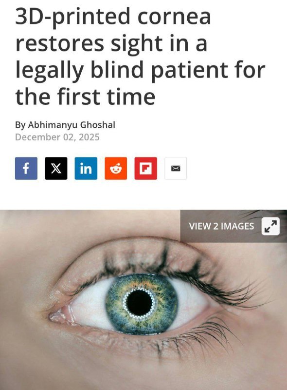 Учёные научились возвращать зрение с помощью 3D печати Учёные научились печатать прозрачный и прочный имплант PB 001 имитирующий роговицу Один донорский материал позволяет изготовить около 300 таких протезов В клинике имплант прижился и восстановил зрение пациенту t me neurosphera