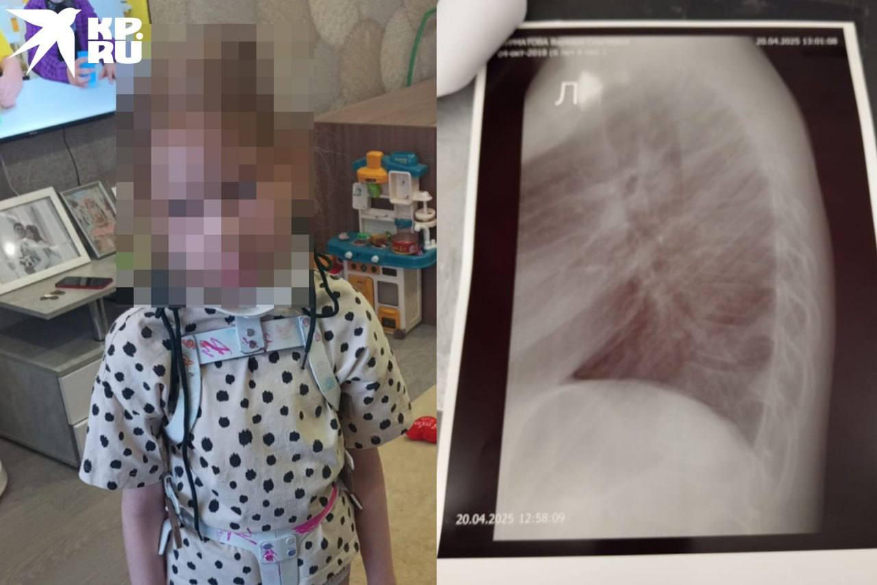 6 летняя девочка сломала позвоночник в детском центре в ТЦ в Калининском районе сотрудники развлекательной точки никак не помогли ребёнку Мать пострадавшей сибирячки рассказала что в центре в день визита работали всего двое сотрудников девочка забежала в лабиринт и скрылась из виду а затем что то пошло не так По словам дочки там она упала лежала на спине В какой именно момент произошло падение дочка не помнит Потом она встала возле стенки скалодрома отдышалась и с трудом дошла до выхода с аттракциона там мы её забрали Дочка была вся в слезах жаловалась на боль в спине Сотрудники детского центра никак не помогли ребенку не вызвали скорую не оказали первой помощи Родители отвезли малышку в травмпункт там ей поставили диагноз компрессионный перелом шести позвонков Девочка вынуждена продолжительное время проходить реабилитацию Директор детского центра как пишет КП Новосибирск в разговоре с родителями вину сотрудников признать отказалась Участковый также провёл проверку по факту ЧП и не нашёл в действиях персонала состава преступления