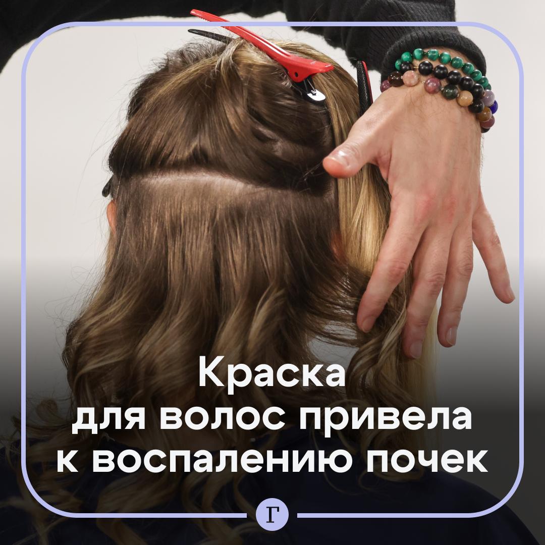 Модница слишком часто красила волосы и заработала воспаление почек Молодая китаянка обновляла прическу каждый месяц чтобы подражать любимой звезде Но в один день у 20 летней девушки заболел живот и суставы а на ногах появилась сыпь В больнице оказалось что это воспаление почек Причиной врачи назвали токсины из краски для волос   Читайте Газету Ru в MAX Участвуйте в розыгрыше
