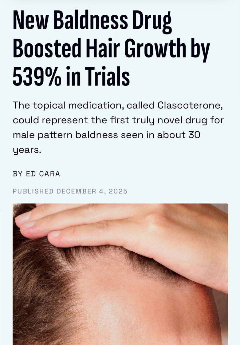 Облысение все Ученые изобрели сыворотку которая увеличивает рост волос за 529 Препарат нужно просто втереть в кожу головы так он воздействует напрямую на гормоны из за которых и выпадают фолликулы Эта разработка претендует стать первым новым лекарством от облысения за последние 30 лет Сейчас она ждет одобрения от ЕС и США после чего попадет в магазины к 2027 году Перешли тому самому другу