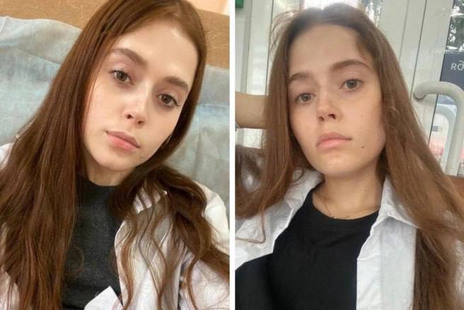 В Новосибирске умерла 23-летняя Татьяна Дроздова, которой Минздрав отказал в закупке лекарства за 50 миллионов  Татьяна с детства страдала тяжелым комбинированным иммунодефицитом — редким генетическим заболеванием. Несмотря на постоянные госпитализации, она окончила школу, мечтала стать врачом и стала первым в России человеком с таким диагнозом, дожившим до 23 лет.  В 2023 году врачи назначили ей препарат Elapegademase-IvIr. Месячный курс стоил более 50 млн рублей. Региональный Минздрав отказался закупать его, Татьяна подала в суд и выиграла, но лекарство так и не получила — ведомство подало апелляцию. В мае её состояние ухудшилось: она дважды перенесла тяжелую пневмонию, жаловалась на одышку, головные боли и частичную потерю зрения, но флюорография, показавшая новую пневмонию, не была доведена до врачей. Её лечили неэффективными антибиотиками.  Мать Татьяны рассказывала, что дежурный врач отказался назначить срочное КТ головного мозга, а лечение не пересматривали. Когда Татьяна кричала от боли и её тошнило, врачи продолжали давать тот же антибиотик, уже не в таблетках, а внутривенно. При этом в листе назначений было указано, что препарат отменён, а кто отменил — неясно.  4 июня утром Татьяна не реагировала на мать. Дежурный врач сказал, что она просто спит, но её всё же увезли в реанимацию. КТ сделать не удалось — кабинет оказался закрыт. Девушка находилась в коме, пациенты с таким же диагнозом экстренно прислали иммуноглобулин, но было уже поздно. Вечером её мать получила звонок: дочь умерла. Предварительная причина — отек мозга.  Это не первая трагедия в семье — младшая сестра Татьяны умерла от того же заболевания в возрасте пяти лет.    Подписаться   Прислать новость
