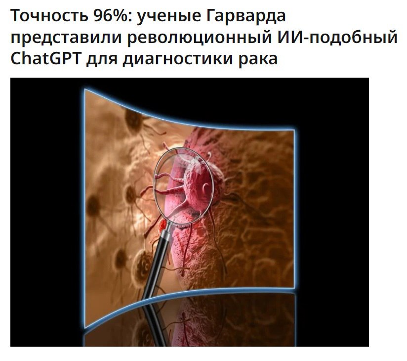 ChatGPT научился диагностировать рак с точностью 96%.  Ученые из Гарварда выпустили новую модель, которая может видеть злокачественные клетки там, где их не видят люди. Технология умеет определять 19 видов рака, рекомендовать лечение и прогнозировать вероятность выживания.  Благодаря ранней диагностике лечение будет эффективней, а выживаемость — выше.  КиберХаб   БотGPT