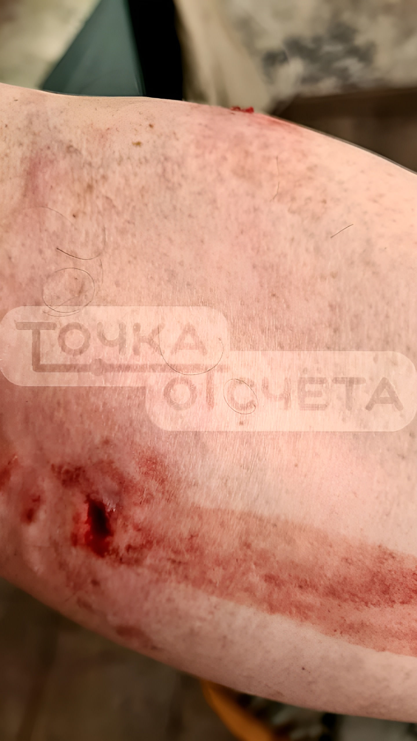 Бойцовая собака атаковала ребёнка в Благовещенске