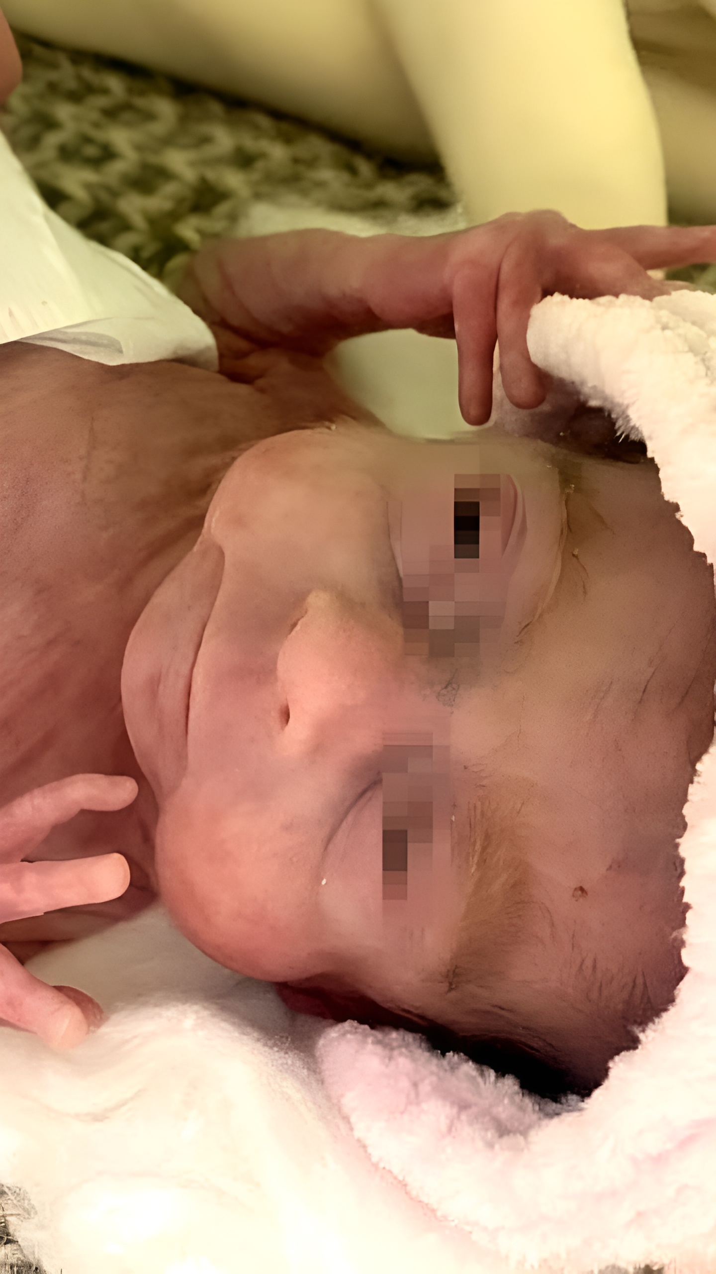 В Уфе и Ямале врачи успешно спасают новорожденных с низким весом