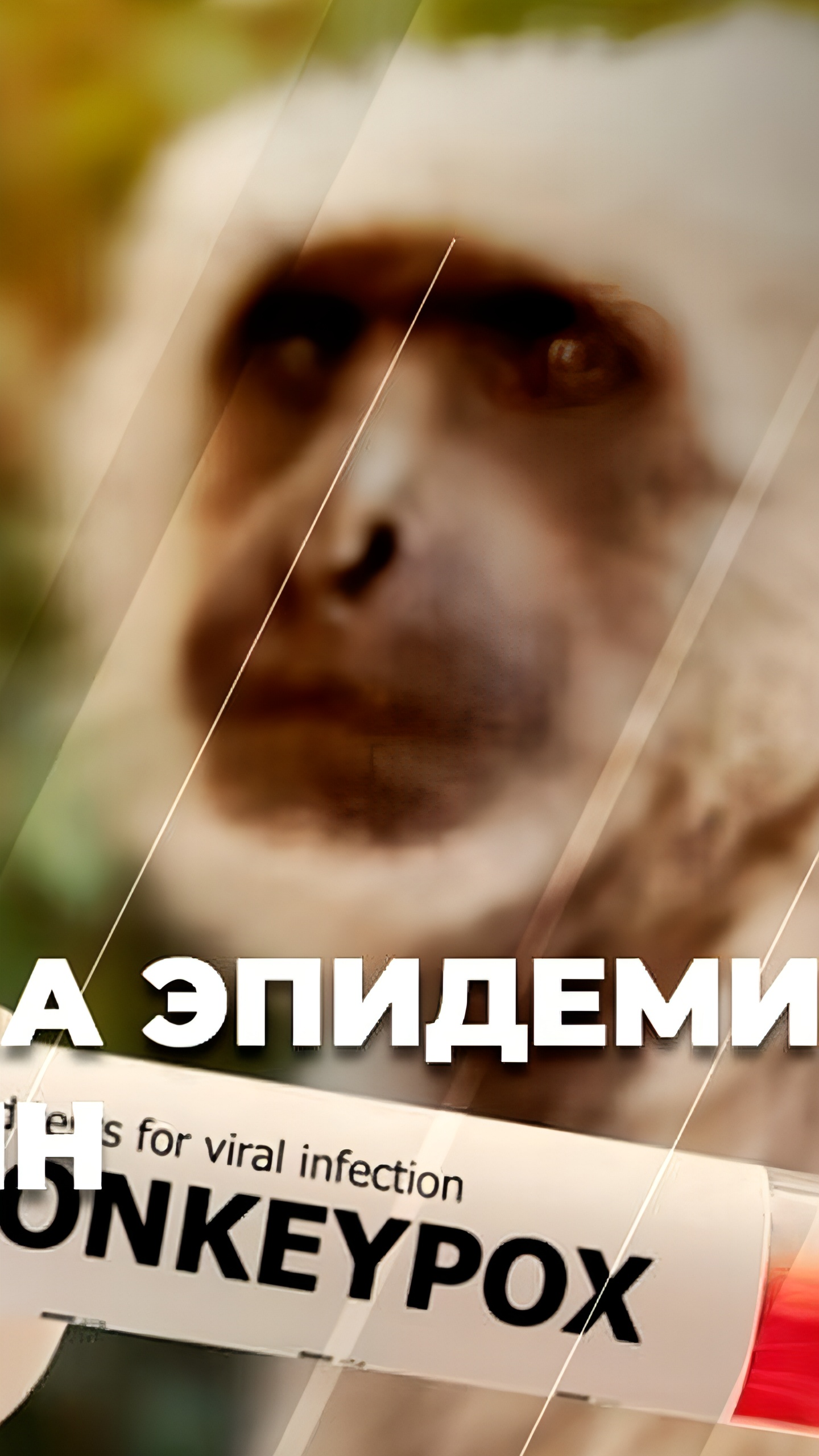 ВОЗ объявила оспу обезьян чрезвычайной ситуацией в области общественного здравоохранения