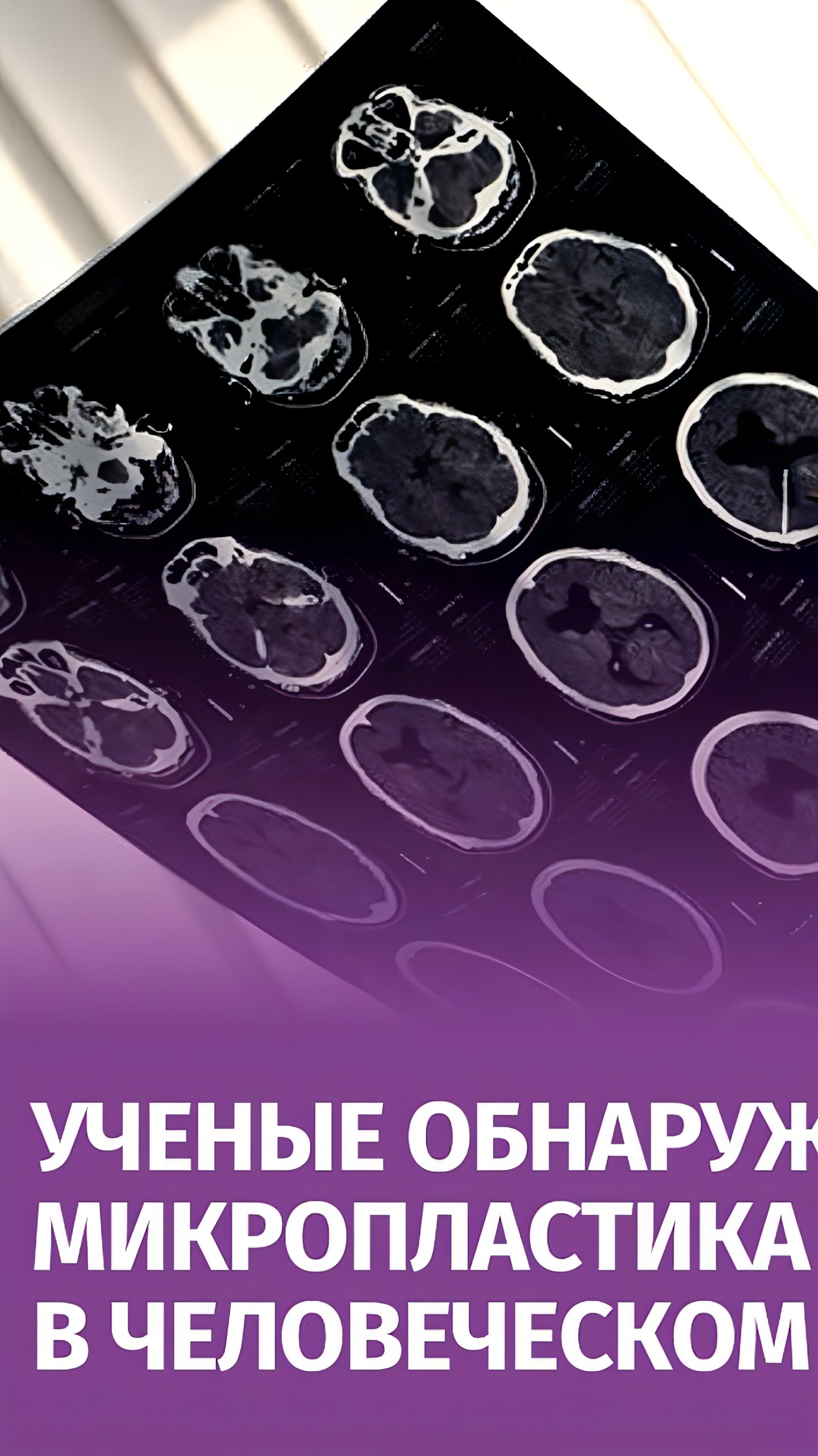 Исследование выявило микропластик в органах человека, включая мозг