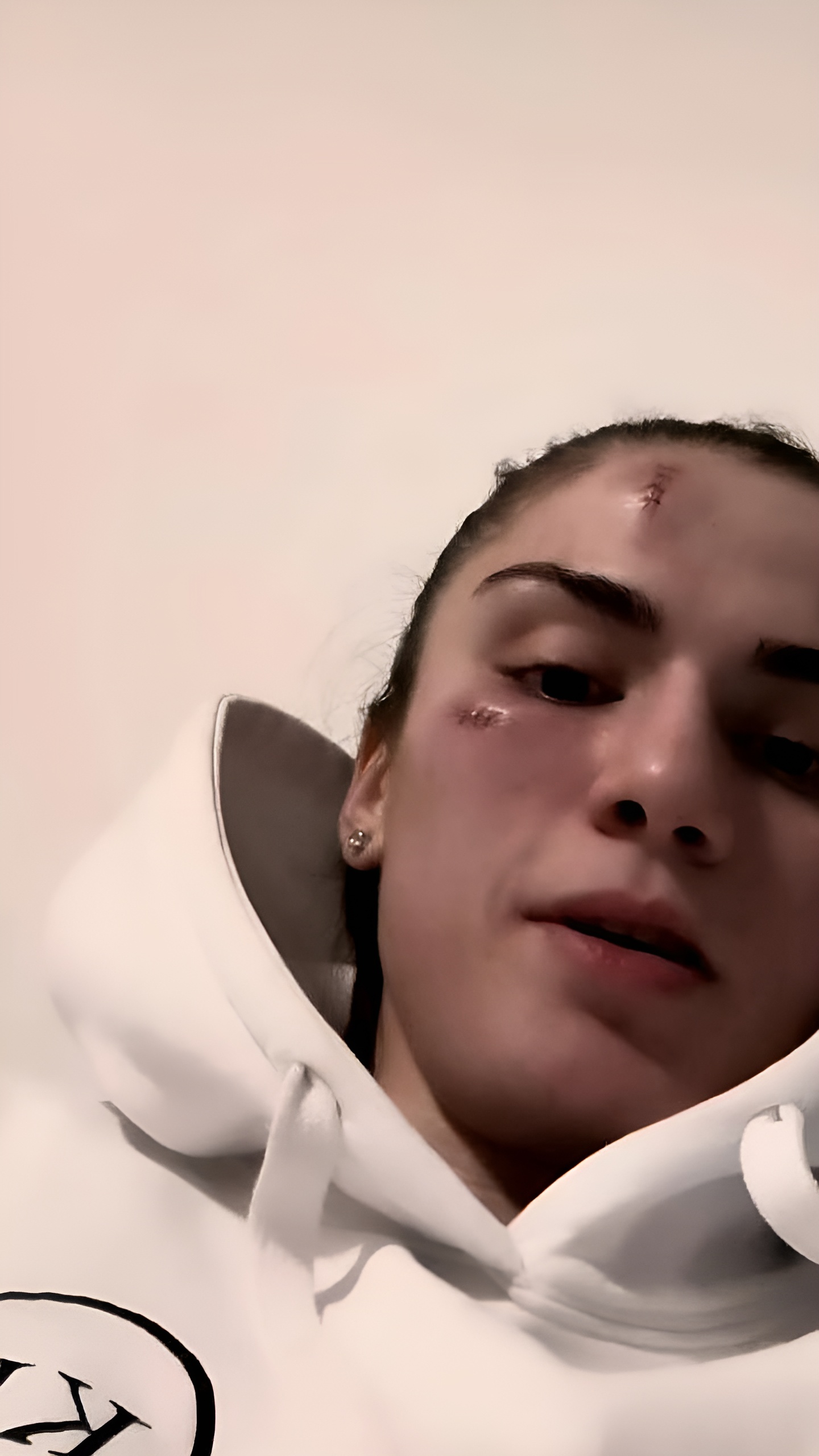 Чеченская боксерка Аминат Эльбукаева вновь стала жертвой нападения в Швейцарии