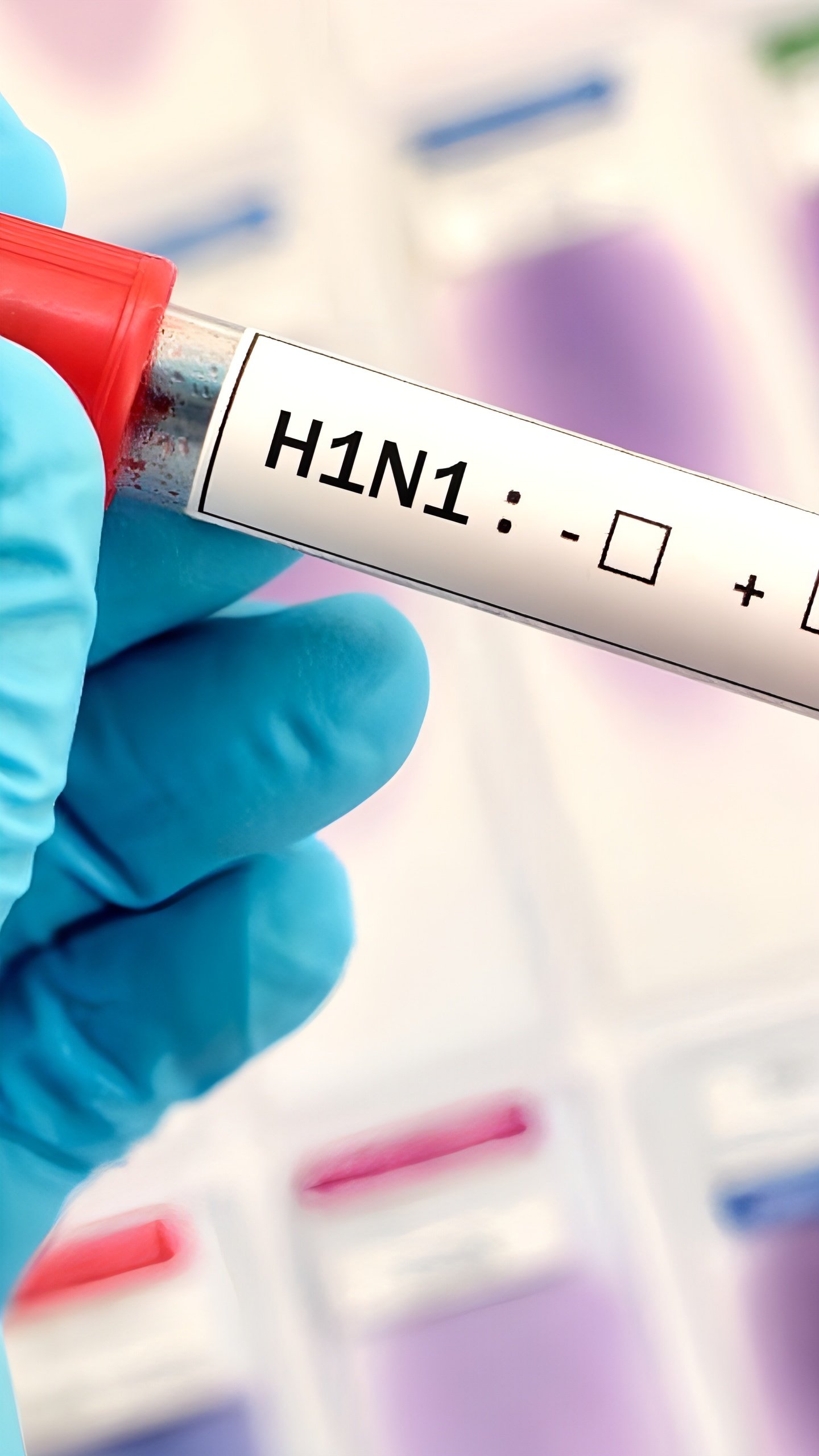 В Хабаровском крае подтверждены 7 случаев свиного гриппа A H1N1