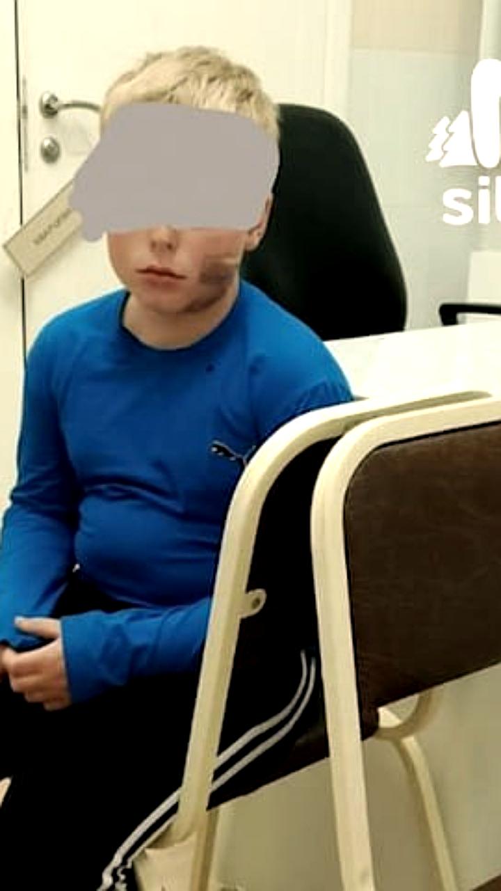 В Омске прокуратура начала проверку после нападения безнадзорной собаки на ребёнка