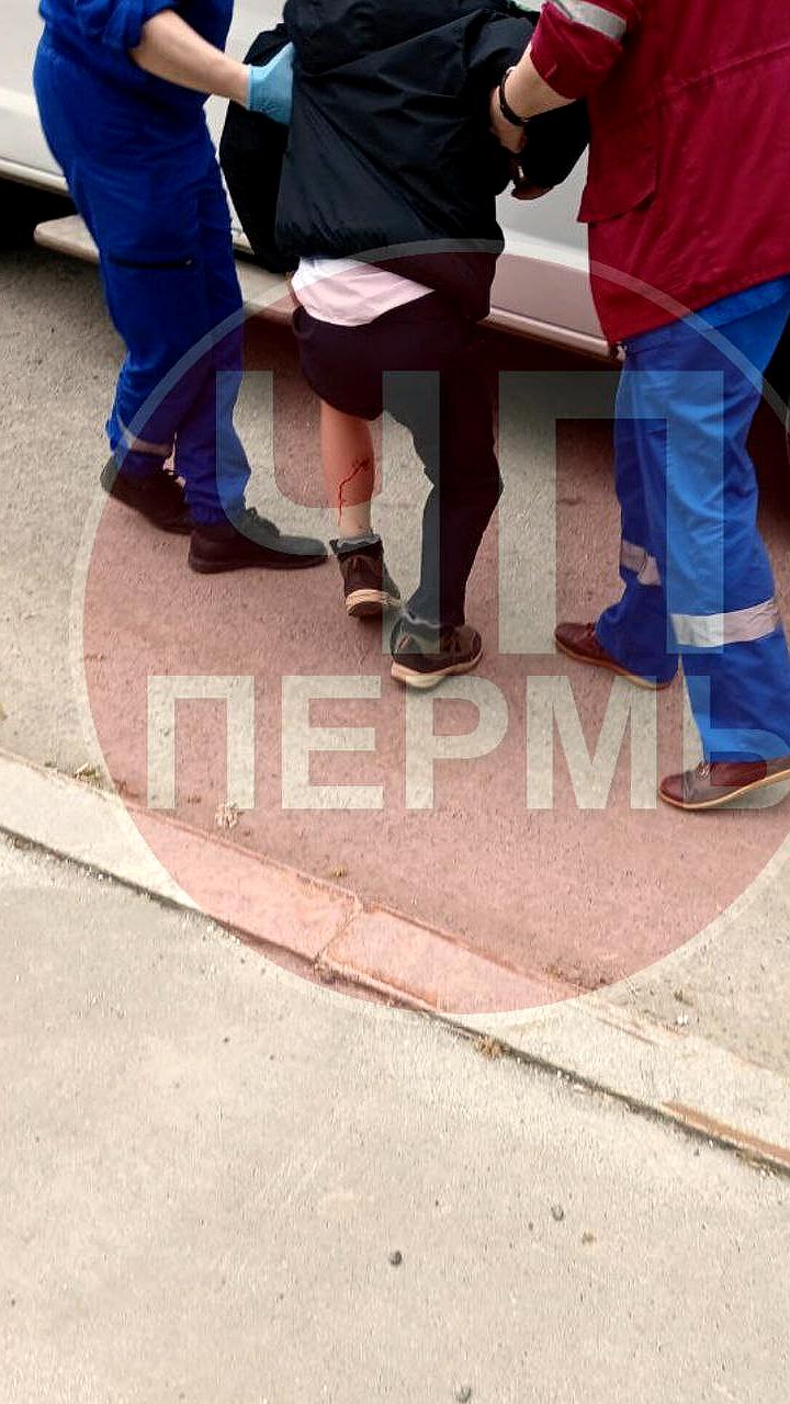 В Перми бродячие собаки напали на детей, один мальчик пострадал