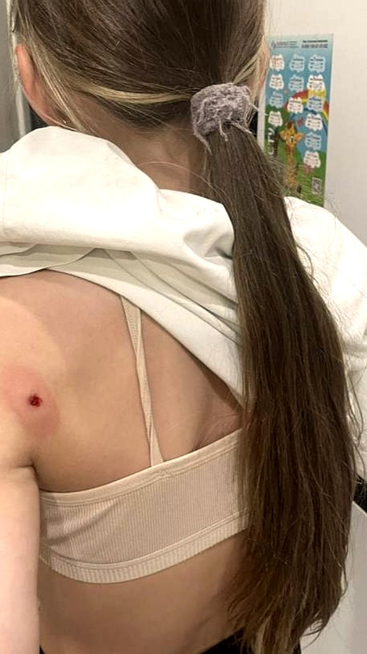 Пенсионер открыл огонь по детям в Ростовской области, пострадала 13-летняя девочка