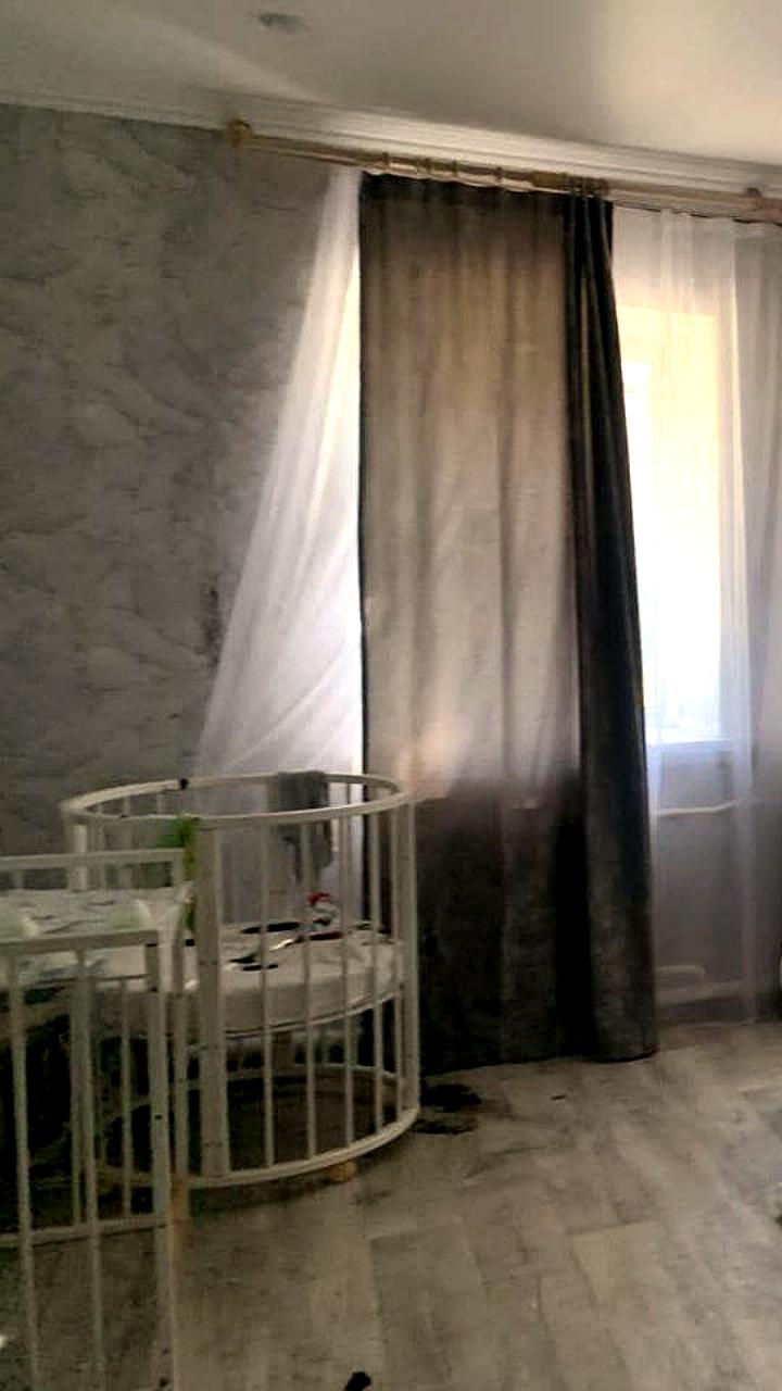 Новорожденный малыш с ожогами после пожара в квартире в Октябрьском