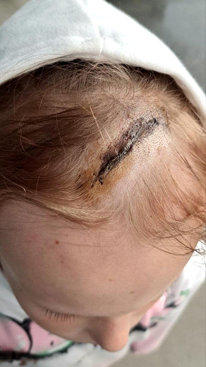 В Александровском саду на туристов упали ветки, пострадала девочка