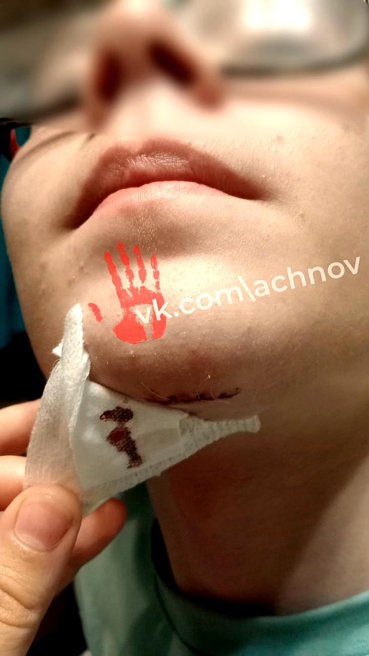 Несчастные случаи с детьми в бассейнах: травмы в термах и частном доме