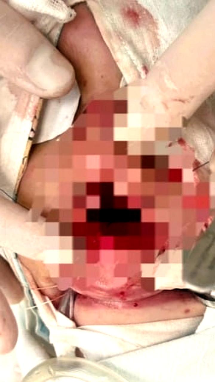 Мальчику из Новосибирска оказали помощь после удара лошади