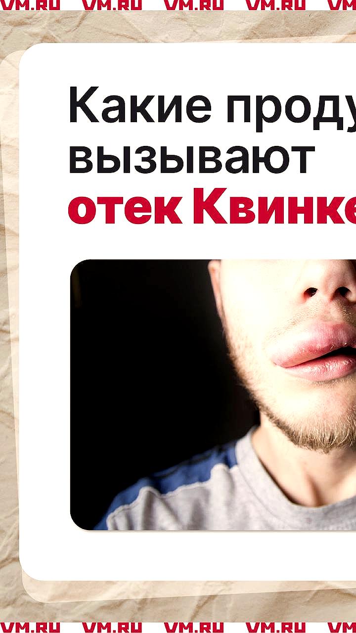 Увеличение случаев дерматитов из-за борщевика в Новосибирске и Москве