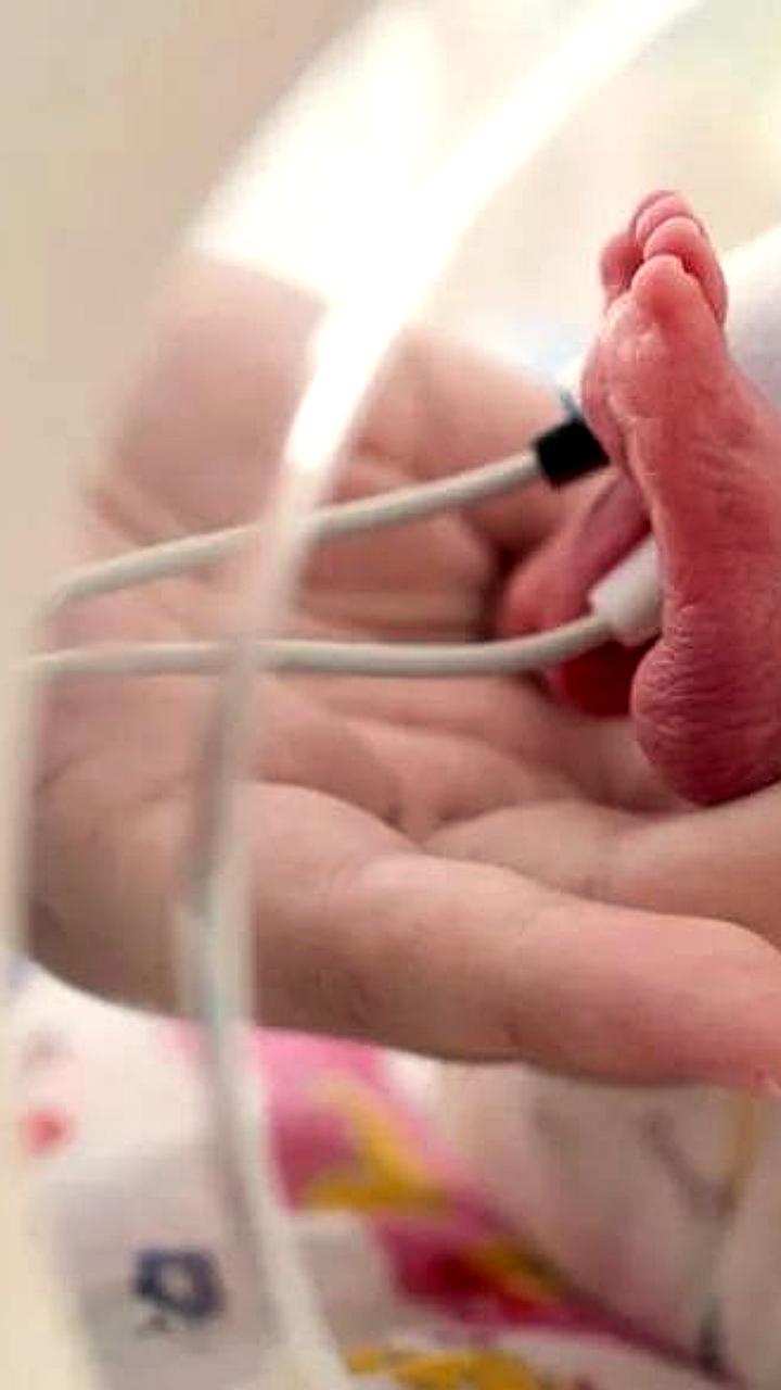 Малыш весом 415 граммов выписан из перинатального центра после трех месяцев лечения