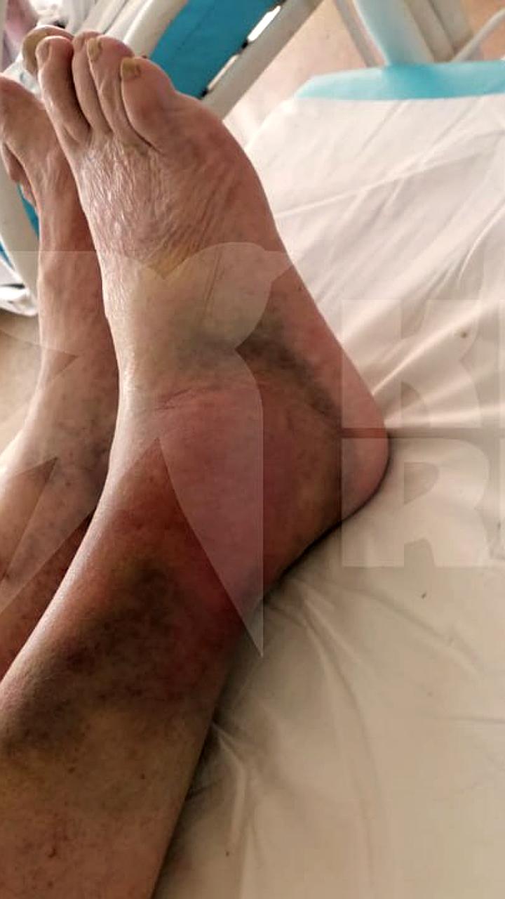 В Самаре водитель скорой помощи избил пенсионера, последствия остаются безнаказанными