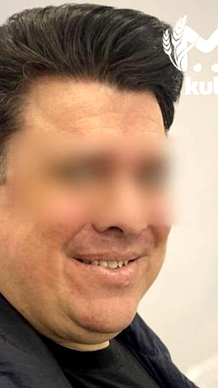 Завкафедрой Башкирского университета получил ожог в Сочи при загадочных обстоятельствах