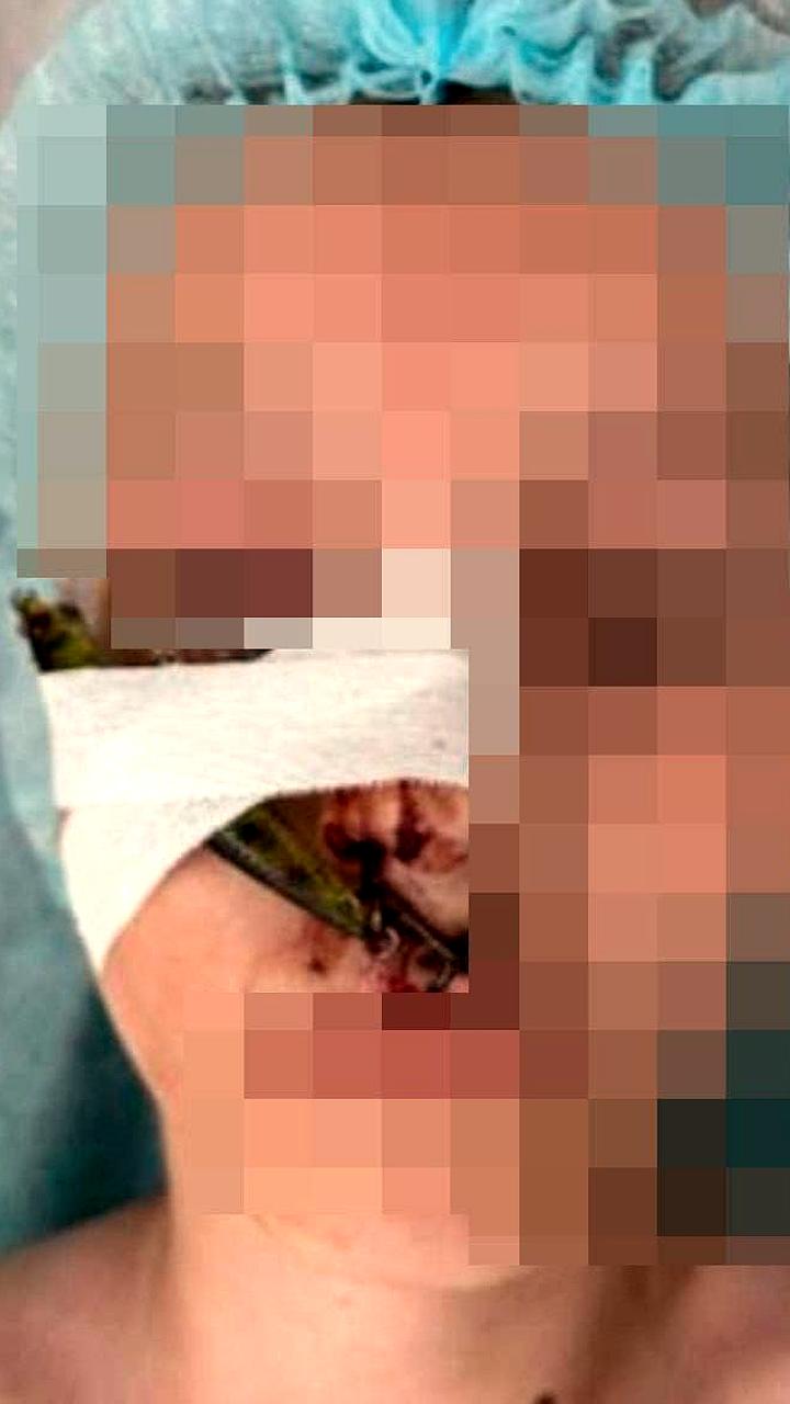 В Рыбнице двое детей госпитализированы с подозрением на отравление