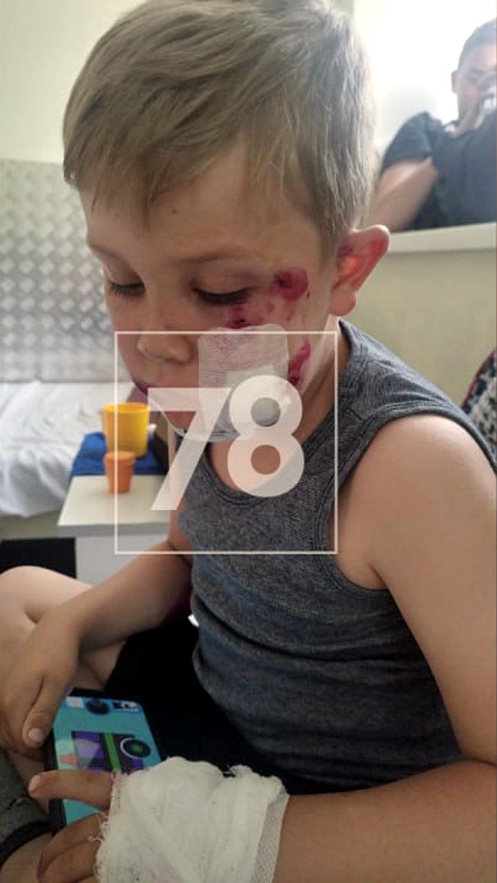 Собака, сбитая на дороге, получает помощь от волонтеров на Сахалине и в Новосибирске