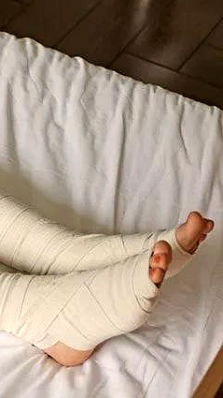 Два инцидента с травмами детей в Хабаровске: ожоги и авария на велосипеде