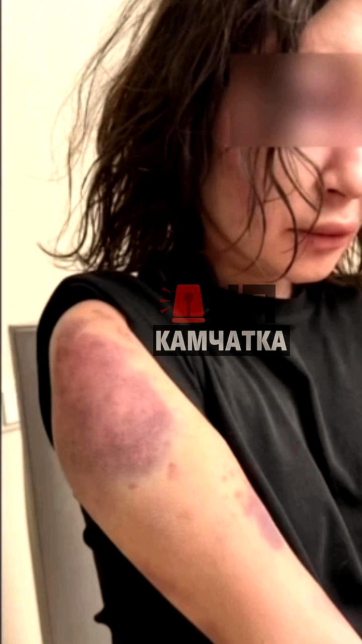На Камчатке судят мужчину за жестокое обращение с сожительницей и собакой