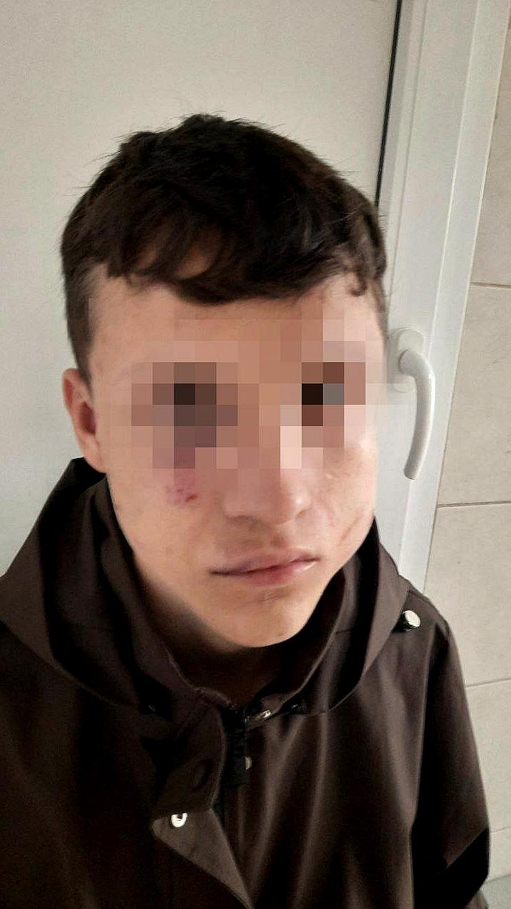 В Тюмени подросток защитил самокат от нападения, используя перцовый баллончик