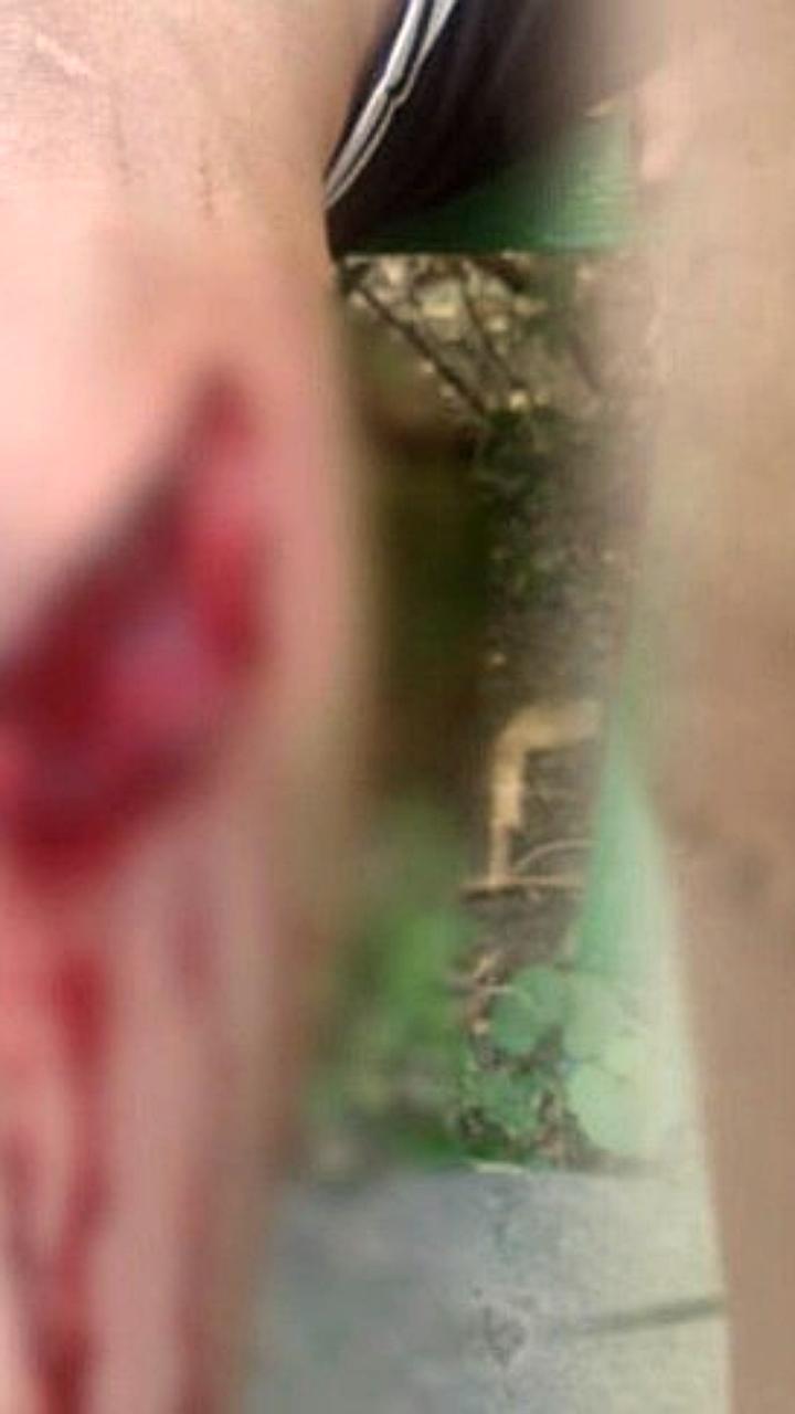Начата проверка по факту травмирования ребенка на детской площадке в Волжском