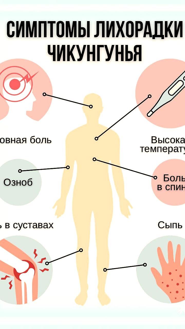 В Китае зафиксировано более 7000 случаев вируса чикунгунья, Роспотребнадзор усиливает контроль