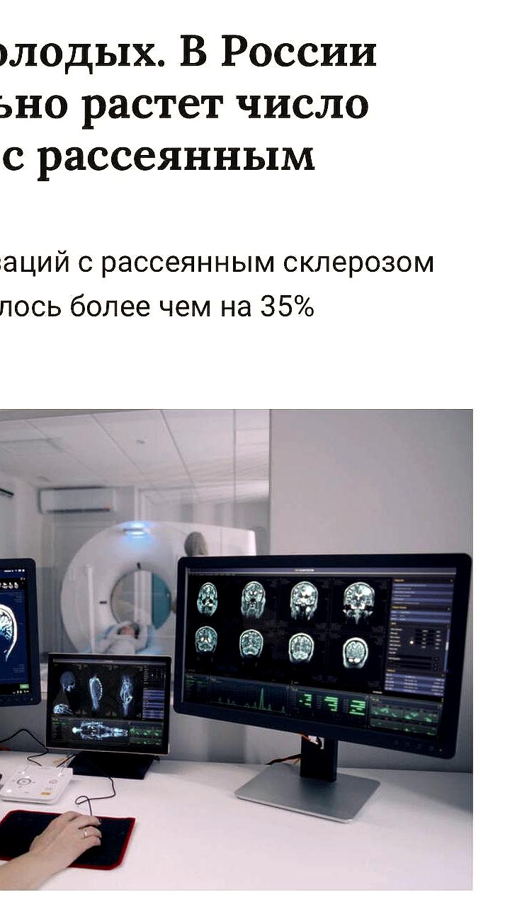 Рост числа пациентов с рассеянным склерозом в России: ежегодный прирост 7%