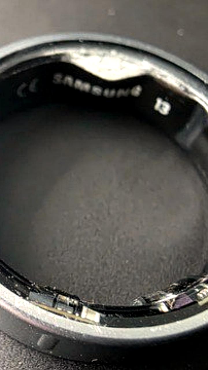 Проблемы с аккумуляторами Galaxy Ring: вздутие батареи приводит к медицинскому вмешательству