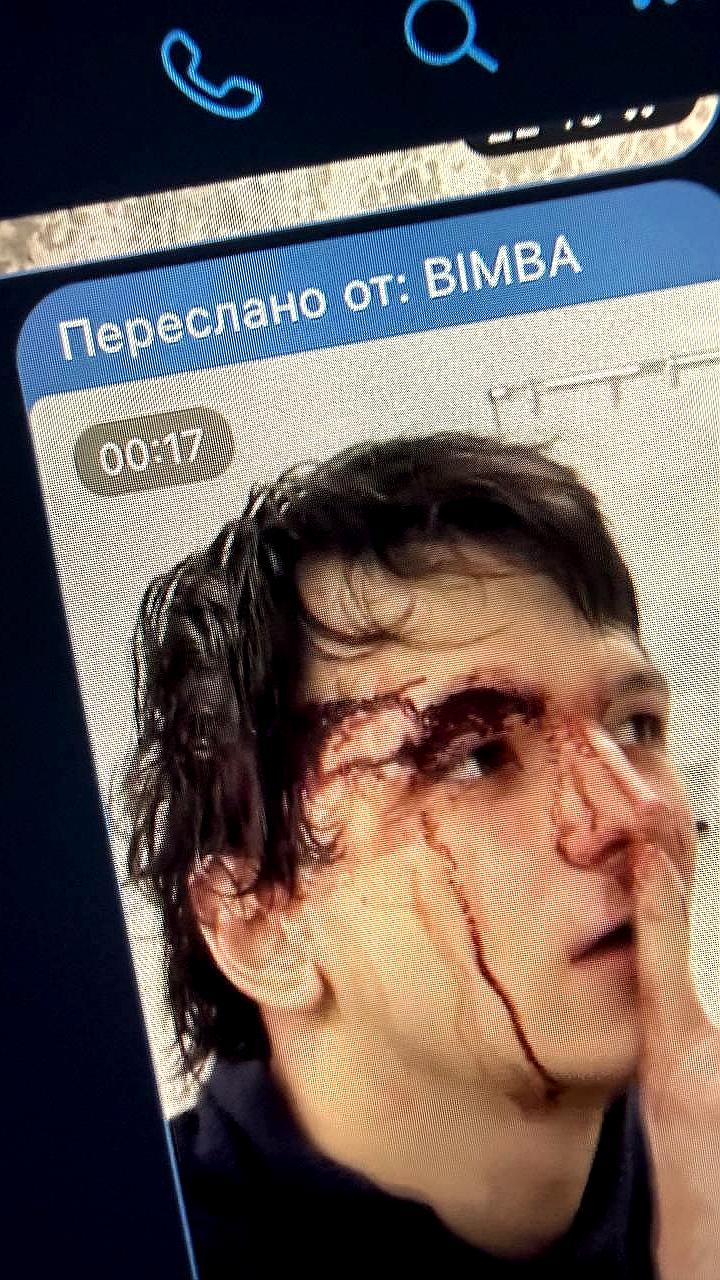 Продюсер утверждает, что падение Vacio с крыши в Париже — часть пиара нового альбома