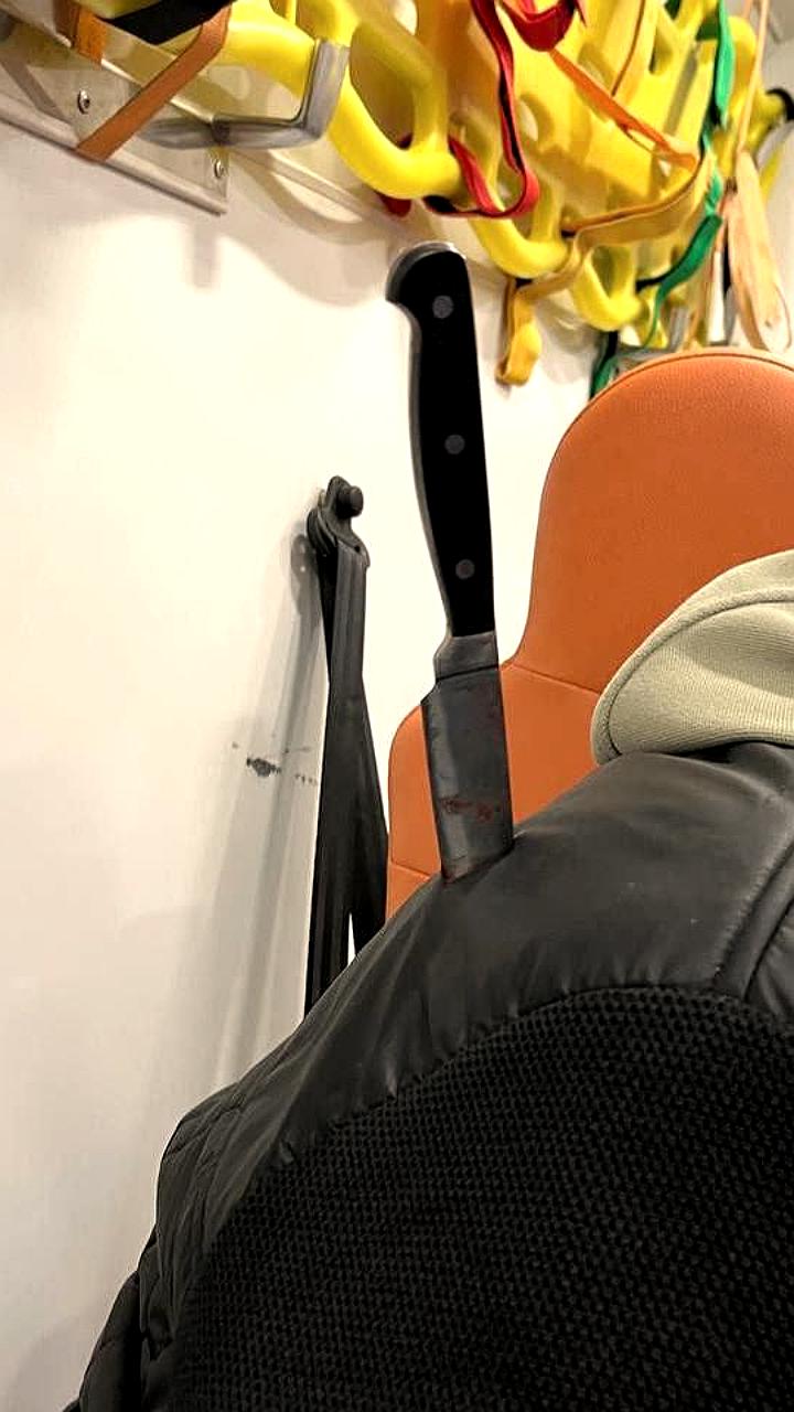 В Подмосковье женщина нанесла ножевое ранение таксисту из-за спора о цене