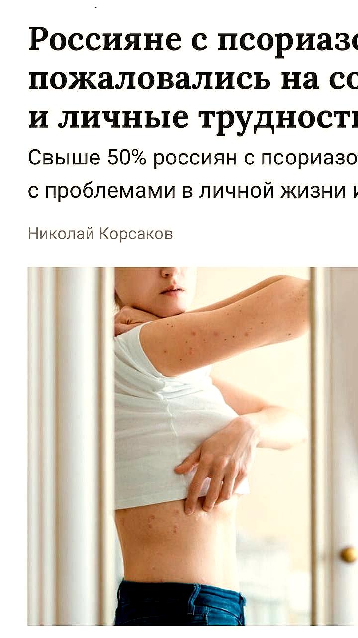 Проблемы с личной жизнью и карьерой у россиян с псориазом: результаты опроса