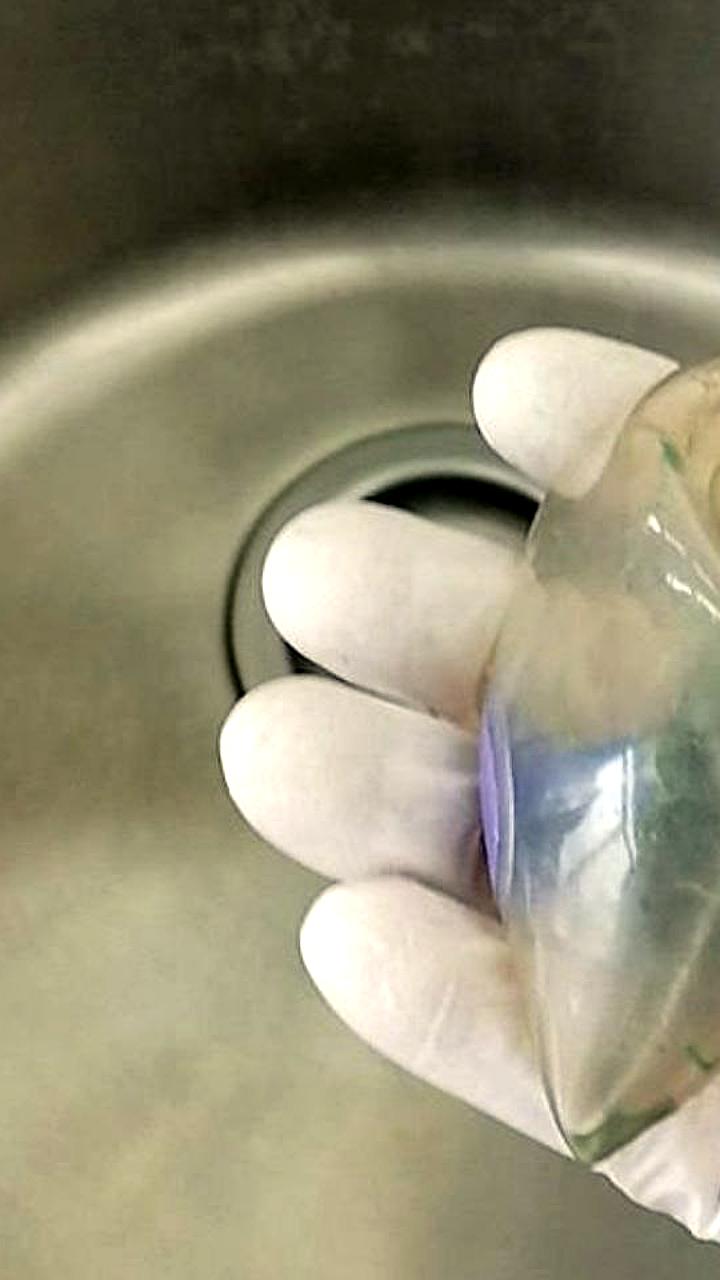 В Находке успешно проведена операция по извлечению гастробаллонa у пациентки с осложнением