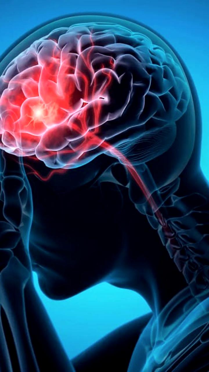 Исследование связывает здоровье зубов с риском инсульта